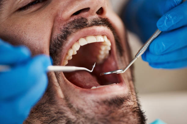 Best Dentist for Tooth Abscess  in Rockland, ME